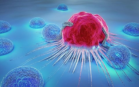  60 بیمار مبتلا به سرطان  روده در گلپایگان شناسایی شد